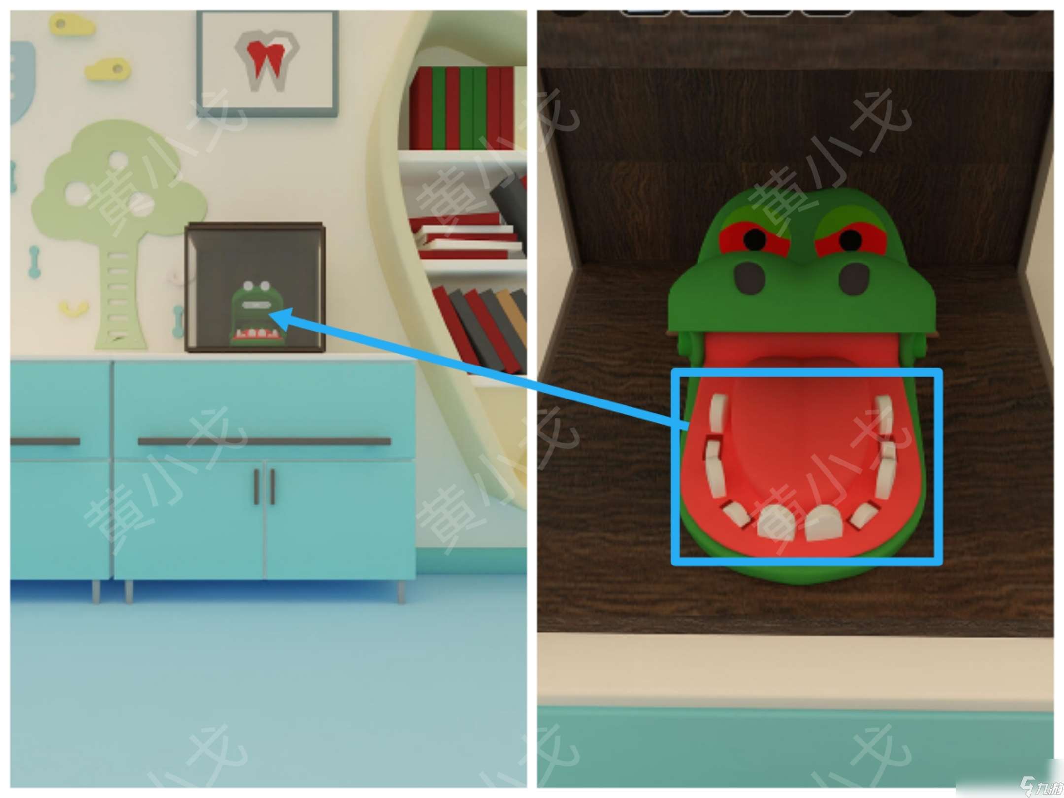 Escape Room：Dental（密室逃脫：牙科診所）攻略（一）