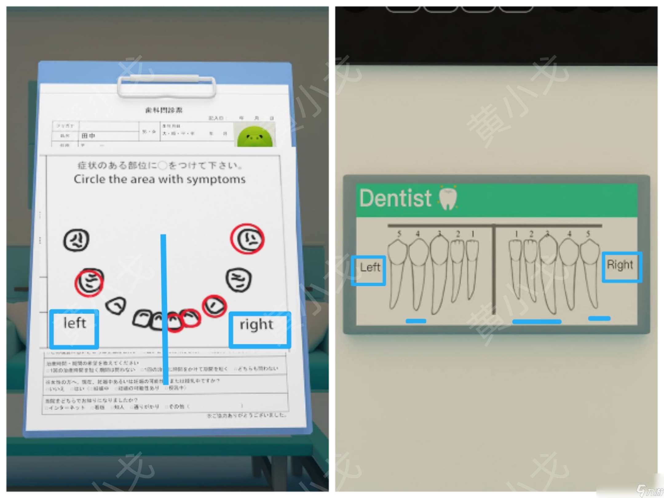 Escape Room：Dental（密室逃脫：牙科診所）攻略（一）