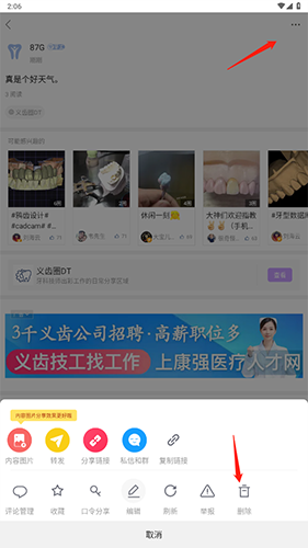 牙匠之家官方版app怎么删除动态2