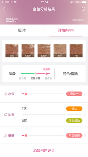 肌肤分析仪app软件截图
